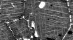 Failure analysis of a heavy gauge fastener of the ITER toroidal field gravity support system